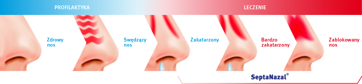 Jak leczyć zablokowany nos