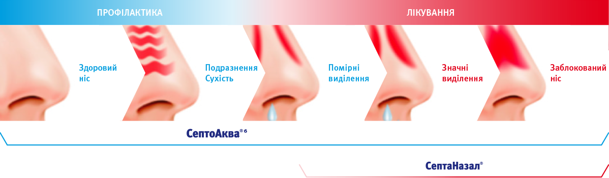 Як лікувати закладений ніс?